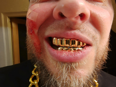 Hiphop zlaté zuby